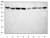 Western blot testing of 1) human HeLa, 2) human 293T, 3) human MCF7, 4) human HepG2, 5) rat brain, 6) rat NRK, 7) mouse brain and 8) mouse NIH 3T3 cell lysate with 4E-T antibody. Expected molecular weight ~88/108 kDa (multiple isoforms but can be observed at ~140 kDa (possibly due to phosphorylation or high proline content-Ref 1).