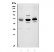 Western blot testing of 1) human HCCT, 2) rat liver and 3) mouse liver tissue lysate with PCCB antibody. Predicted molecular weight: 58-61 kDa (two isoforms).