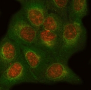 Immunofluorescent staining of FFPE human U-2 OS cells with ONECUT1 antibody (red) and Beta Tubulin mAb (green). HIER: steam section in pH6 citrate buffer for 20 min.