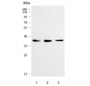 Western blot testing of human 1) T-47D, 2) RT4 and 3) MOLT4 cell lysate with SVOPL antibody. Predicted molecular weight ~37 kDa and ~54 kDa (two isoforms).
