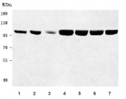 Western blot testing of 1) human HepG2, 2) human SH-SY5Y, 3) human U-2 OS, 4) rat brain, 5) rat kidney, 6) mouse brain and 7) mouse kidney tissue lysate with OGDHL antibody. Predicted molecular weight: 91-114 kDa (multiple isoforms).