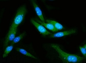Immunofluorescent staining of FFPE human PC-3 cells with GSDMD antibody (green) and DAPI nuclear stain (blue). HIER: steam section in pH6 citrate buffer for 20 min.