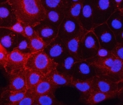 Immunofluorescent staining of FFPE human Caco-2 cells with PDGFR alpha antibody (red) and DAPI nuclear stain (blue). HIER: steam section in pH6 citrate buffer for 20 min.