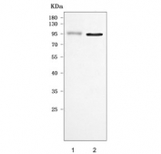 Western blot testing of 1) human Jurkat and 2) mouse testis tissue lysate with ORP9 antibody. Predicted molecular weight: 63-84 kDa (multiple isoforms).