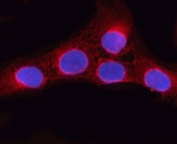 Immunofluorescent staining of FFPE human U-2 OS cells with ORP9 antibody (red) and DAPI nuclear stain (blue). HIER: steam section in pH6 citrate buffer for 20 min.