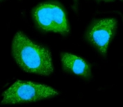 Immunofluorescent staining of FFPE human SiHa cells with GNB1 antibody (green) and DAPI nuclear stain (blue). HIER: steam section in pH6 citrate buffer for 20 min.