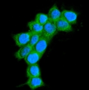 Immunofluorescent staining of FFPE human MCF7 cells with AlaRS antibody (green) and DAPI nuclear stain (blue). HIER: steam section in pH6 citrate buffer for 20 min.