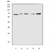 Western blot testing of 1) rat stomach, 2) rat kidney, 3) rat testis, 4) mouse kidney and 5) mouse testis tissue lysate with ATIC antibody. Predicted molecular weight ~65 kDa.