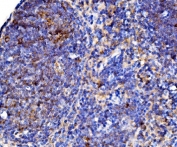 IHC staining of FFPE mouse lymph node tissue with Cd38 antibody. HIER: boil tissue sections in pH8 EDTA for 20 min and allow to cool before testing.