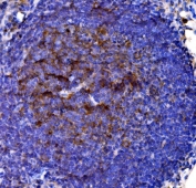 IHC staining of FFPE rat lymph node tissue with Cd38 antibody. HIER: boil tissue sections in pH8 EDTA for 20 min and allow to cool before testing.