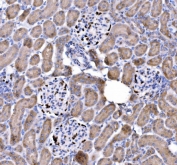 IHC staining of FFPE human rat kidney tissue with p57Kip2 antibody. HIER: boil tissue sections in pH8 EDTA for 20 min and allow to cool before testing.