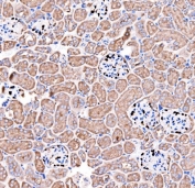 IHC staining of FFPE human mouse kidney tissue with p57Kip2 antibody. HIER: boil tissue sections in pH8 EDTA for 20 min and allow to cool before testing.