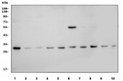 Western blot testing of 1) human Jurkat, 2) human HepG2, 3) human A549, 4) human ThP-1, 5) human Raji, 6) human SW620, 7) human Caco-2, 8) human HEK293, 9) rat PC-12 and 10) mouse NIH 3T3 cell lysate with p57Kip2 antibody. Predicted molecular weight ~32 kDa but can be observed at ~57 kDa.