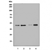 Western blot testing of 1) rat brain, 2) rat PC-12, 3) human U-2 OS and 4) human HepG2 cell lysate with Calponin 3 antibody. Predicted molecular weight ~36 kDa.
