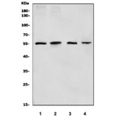 Western blot testing of 1) mouse lung, 2) mouse stomach, 3) rat kidney and 4) rat PC-12 cell lysate with Death-associated protein kinase 3 antibody. Predicted molecular weight ~51 kDa.