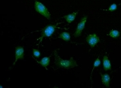 Immunofluorescent staining of FFPE human RM-1 cells with Death-associated protein kinase 3 antibody (green) and DAPI nuclear stain (blue). HIER: steam section in pH6 citrate buffer for 20 min.