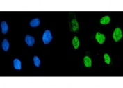 Immunofluorescent staining of FFPE human Caco-2 cells with FUBP2 antibody (green) and DAPI nuclear stain (blue). HIER: steam section in pH6 citrate buffer for 20 min.