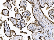 IHC staining of FFPE human placental tissue with KIF2A antibody. HIER: boil tissue sections in pH8 EDTA for 20 min and allow to cool before testing.