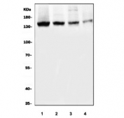 Western blot testing of human 1) SK-O-V3, 2) HEL, 3) K562 and 4) Caco-2 cell lysate with PRDM3 antibody. Predicted molecular weight ~138 kDa.