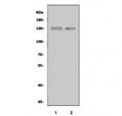 Western blot testing of 1) rat brain and 2) mouse brain tissue lysate with NTRK3 antibody. Predicted molecular weight ~94 kDa but may be observed a higher molecular weights due to glycosylation.