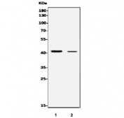 Western blot testing of 1) rat brain and 2) mouse brain tissue lysate with P2y12 antibody. Predicted molecular weight ~40 kDa.