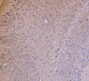 IHC staining of FFPE mouse brain tissue with PIK3R1 antibody. HIER: boil tissue sections in pH8 EDTA for 20 min and allow to cool before testing.