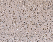 IHC staining of FFPE rat brain tissue with PIK3R1 antibody. HIER: boil tissue sections in pH8 EDTA for 20 min and allow to cool before testing.