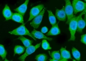 Immunofluorescent staining of FFPE human Caco-2 cells with PIK3R1 antibody (green) and DAPI nuclear stain (blue). HIER: steam section in pH6 citrate buffer for 20 min.