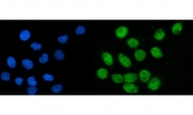 Immunofluorescent staining of FFPE human SiHa cells with CoREST antibody (green) and DAPI nuclear stain (blue). HIER: steam section in pH6 citrate buffer for 20 min.