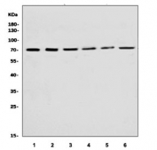 Western blot testing of human 1) MCF7, 2) Jurkat, 3) HepG2, 4) U-2 OS, 5) T-47D and 6) Raji cell lysate with Sur8 antibody. Predicted molecular weight ~65 kDa, 60 kDa (two isoforms).