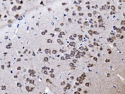 IHC staining of FFPE mouse brain tissue with Sur8 antibody. HIER: boil tissue sections in pH8 EDTA for 20 min and allow to cool before testing.