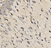 IHC staining of FFPE rat brain tissue with Sur8 antibody. HIER: boil tissue sections in pH8 EDTA for 20 min and allow to cool before testing.