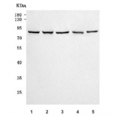 Western blot testing of 1) human K562, 2) human Raji, 3) human MCF7, 4) rat brain and 5) mouse brain tissue lysate with PRPF39 antibody. Predicted molecular weight ~78 kDa.