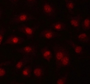 Immunofluorescent staining of FFPE human A549 cells with PRPF39 antibody. HIER: steam section in pH6 citrate buffer for 20 min.