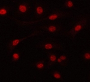 Immunofluorescent staining of FFPE human A549 cells with PRPF6 antibody. HIER: steam section in pH6 citrate buffer for 20 min.