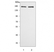 Western blot testing of 1) rat brain and 2) mouse brain tissue lysate with CASPR2 antibody. Predicted molecular weight ~148 kDa but may be observed at higher molecular weights due to glycosylation.