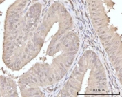 IHC staining of FFPE human uterus tissue with Recoverin antibody. HIER: boil tissue sections in pH8 EDTA for 20 min and allow to cool before testing.
