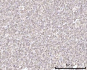 IHC staining of FFPE human tonsil tissue with Recoverin antibody. HIER: boil tissue sections in pH8 EDTA for 20 min and allow to cool before testing.