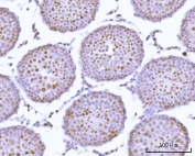 IHC staining of FFPE rat testis tissue with PRPF18 antibody. HIER: boil tissue sections in pH8 EDTA for 20 min and allow to cool before testing.