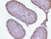 IHC staining of FFPE mouse testis tissue with PRPF18 antibody. HIER: boil tissue sections in pH8 EDTA for 20 min and allow to cool before testing.