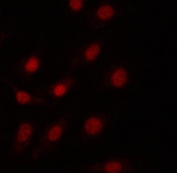 Immunofluorescent staining of FFPE human A549 cells with PRPF18 antibody. HIER: steam section in pH6 citrate buffer for 20 min.