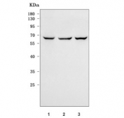 Western blot testing of human 1) U-251, 2) HeLa and 3) HepG2 cell lysate with RIO2 antibody. Predicted molecular weight ~63 kDa, 55 kDa (two isoforms).