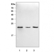 Western blot testing of human 1) A549, 2) HeLa and 3) PC-3 cell lysate with RRAS antibody. Predicted molecular weight ~23 kDa.
