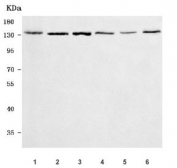 Western blot testing of 1) human HepG2, 2) human HEL, 3) human Daudi, 4) rat PC-12, 5) mouse thymus and 6) mouse NIH 3T3 cell lysate with PAN2 antibody. Predicted molecular weight ~135 kDa.
