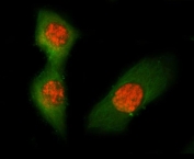 Immunofluorescent staining of FFPE mouse RM-1 cells with Asc antibody (red) and Alpha Tubulin mAb (green). HIER: steam section in pH6 citrate buffer for 20 min.