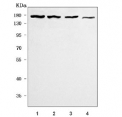 Western blot testing of 1) human MOLT4, 2) human Daudi, 3) human HEL and 4) mouse brain tissue lysate with AS3 antibody. Predicted molecular weight ~165 kDa.