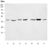 Western blot testing of 1) human 293T, 2) human Raji, 3) rat spleen, 4) rat thymus, 5) mouse spleen, 6) mouse thymus and 7) mouse RAW264.7 cell lysate with C-C chemokine receptor type 4 antibody. Predicted molecular weight ~41 kDa but may be observed at higher molecular weights due to glycosylation.