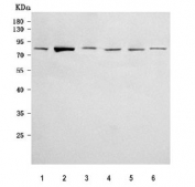 Western blot testing of 1) human A431, 2) human 293T, 3) human Caco-2, 4) human PC-3, 5) rat brain and 6) mouse brain tissue lysate with Delta-like protein 4 antibody. Predicted molecular weight ~75 kDa but may be observed at higher molecular weights due to glycosylation.