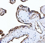 IHC staining of FFPE human placental tissue with PLEKHG5 antibody. HIER: boil tissue sections in pH8 EDTA for 20 min and allow to cool before testing.