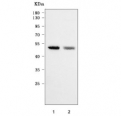 Western blot testing of human 1) 293T and 2) HEL cell lysate with PLVAP antibody. Predicted molecular weight ~51 kDa.